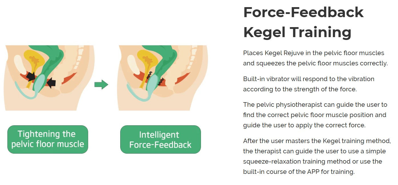 Magic Motion Rejuve FitCute App-Controlled Smart Kegel Trainer