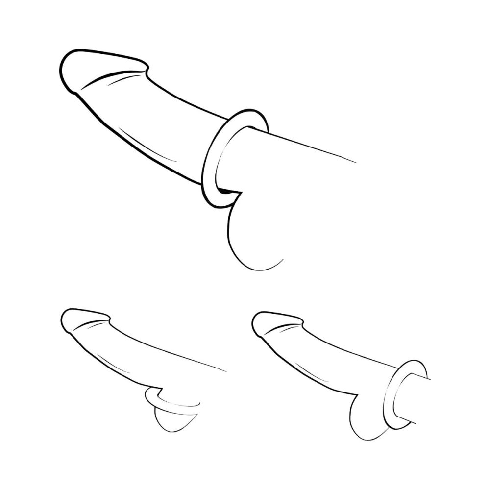 Romp Remix Trio Penis Rings Triple The Thrill 3-Piece Silicone Cock Rings